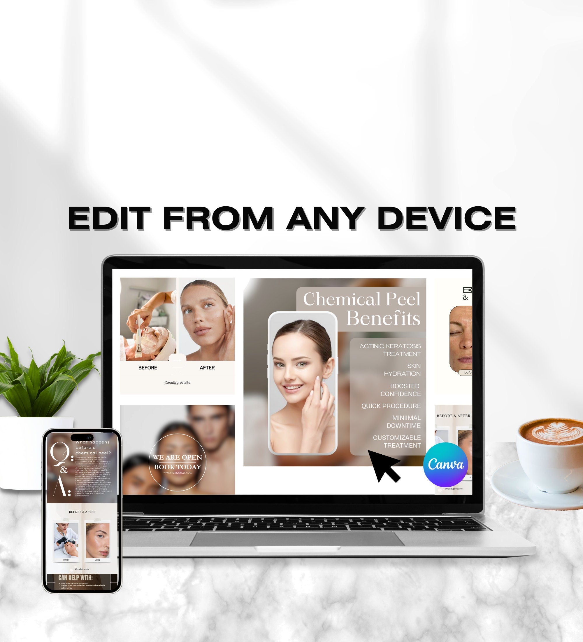Chemical Peel Instagram Templates | Esthetician Instagram | Facial Treatment | Skincare Social Media | Skincare Instagram Templates | MEDSPA