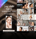 Chemical Peel Instagram Templates | Esthetician Instagram | Facial Treatment | Skincare Social Media | Skincare Instagram Templates | MEDSPA