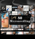 Microneedling Instagram Posts | Esthetician Instagram | Medspa Instagram | Tattoo Artist | Beauty Business | RF Microneedling | Skincare