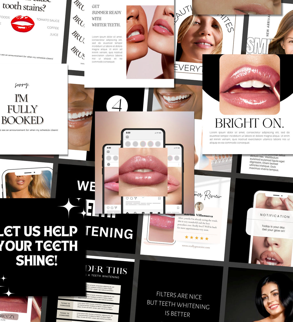 240 Teeth Whitening Instagram Templates | Teeth Whitening Instagram Templates | Teeth Whitening Posts | Teeth Whitening Social Media Posts