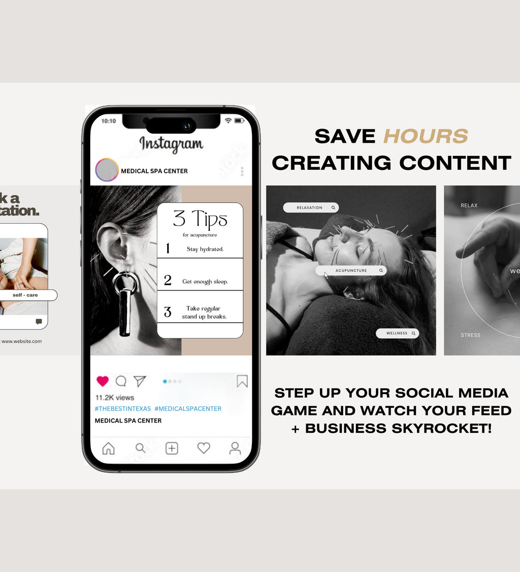 120 Acupuncture Instagram Post Templates | Canva Social Media (Digital Download)