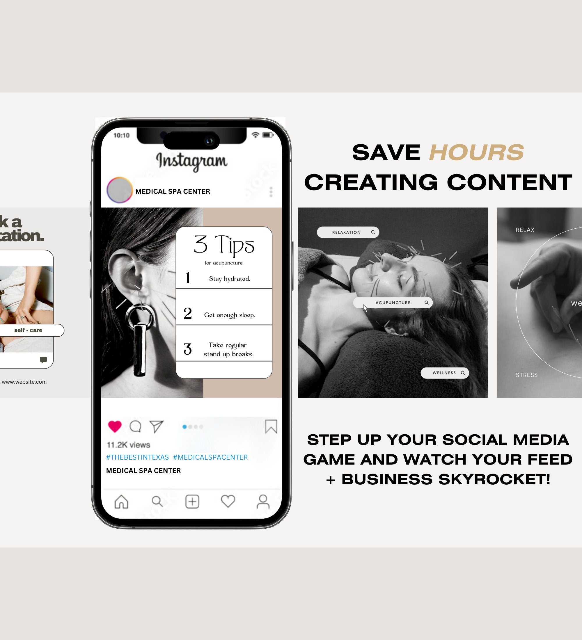 120 Acupuncture Instagram Post Templates | Canva Social Media (Digital Download)