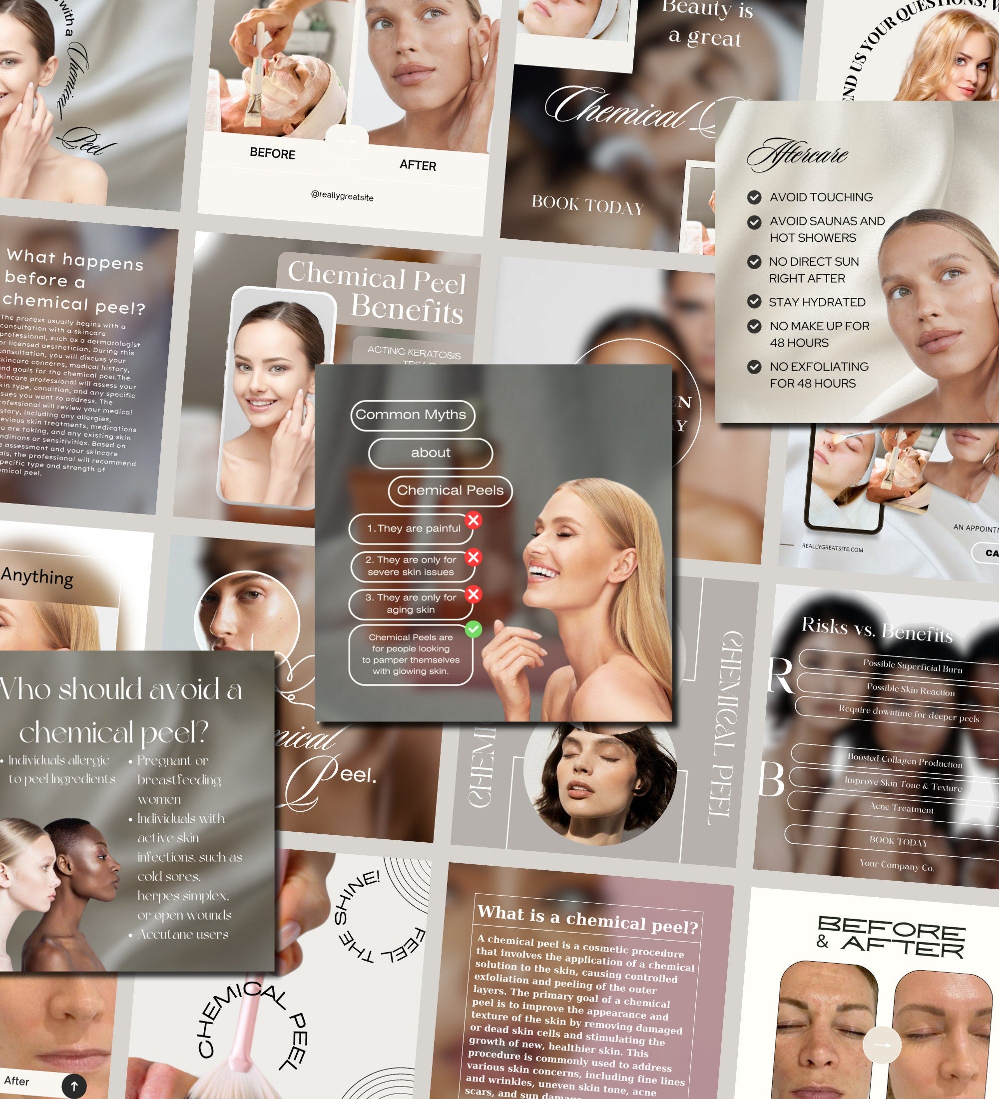 Chemical Peel Instagram Templates | Esthetician Instagram | Facial Treatment | Skincare Social Media | Skincare Instagram Templates | MEDSPA