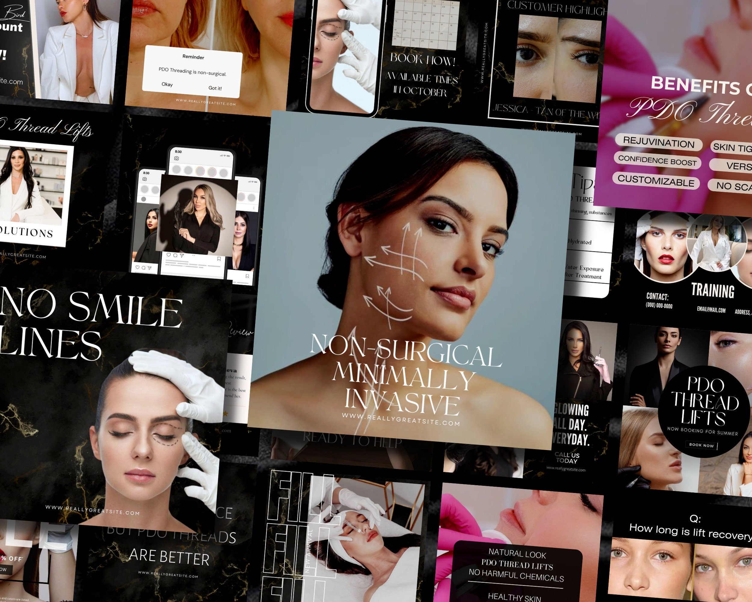 100 PDO Threads Instagram Templates | Nurse Injector Instagram | Facial Thread Lift Instagram | Medspa | Face Lift | Thread Lift | Luxury