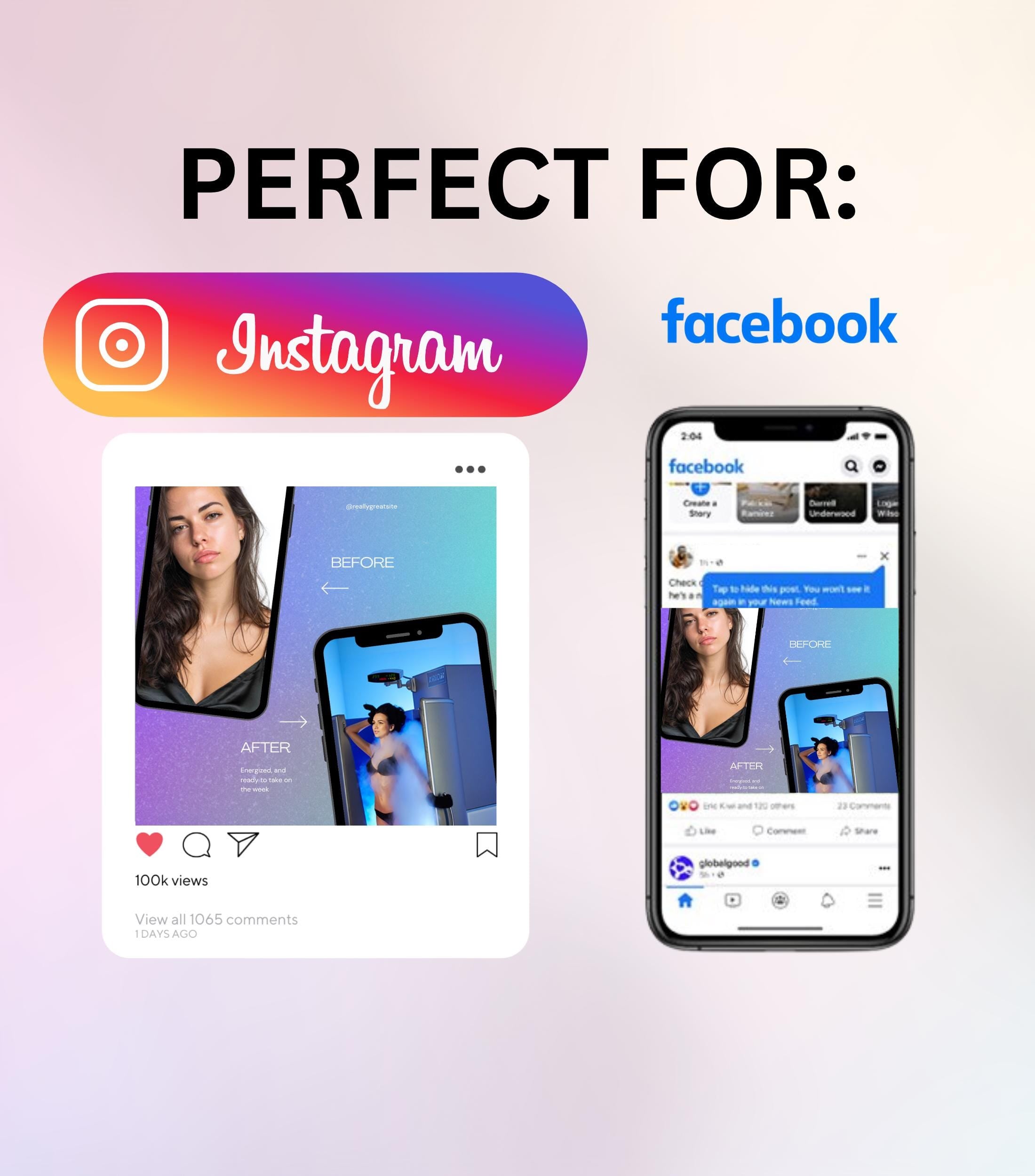 Cryotherapy Instagram Templates | Cryotherapy Posts | Cryotherapy Flyer | Cryotherapy Business IG Posts | Social Media Marketing | Medspa